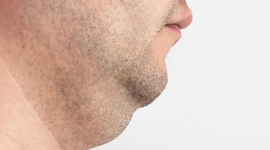 روغن رفع غبغب • آبان ۲۵ام, ۱۴۰۴ ماساژ روزانه غبغب با روغن