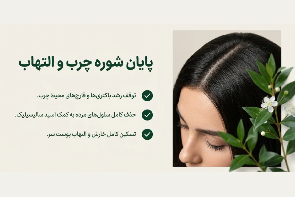 شامپو کنترل‌کننده چربی آلسی هرب برای پوست سر مستعد چربی و شوره و التهاب