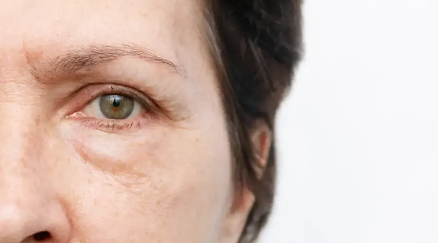 روغن مناسب برای پوست حساس دور چشم