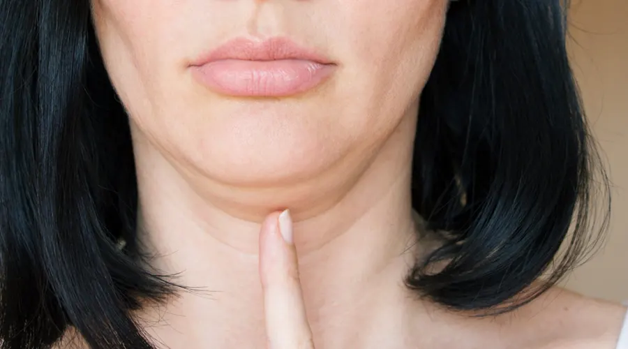 روغن رفع غبغب • آبان ۲۵ام, ۱۴۰۴ خرید روغن رفع غبغب