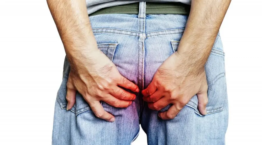 خرید پماد بواسیر برای کاهش سوزش و ناراحتی