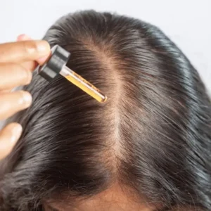 روش طبیعی رفع چربی کف سر با روغن رزماری