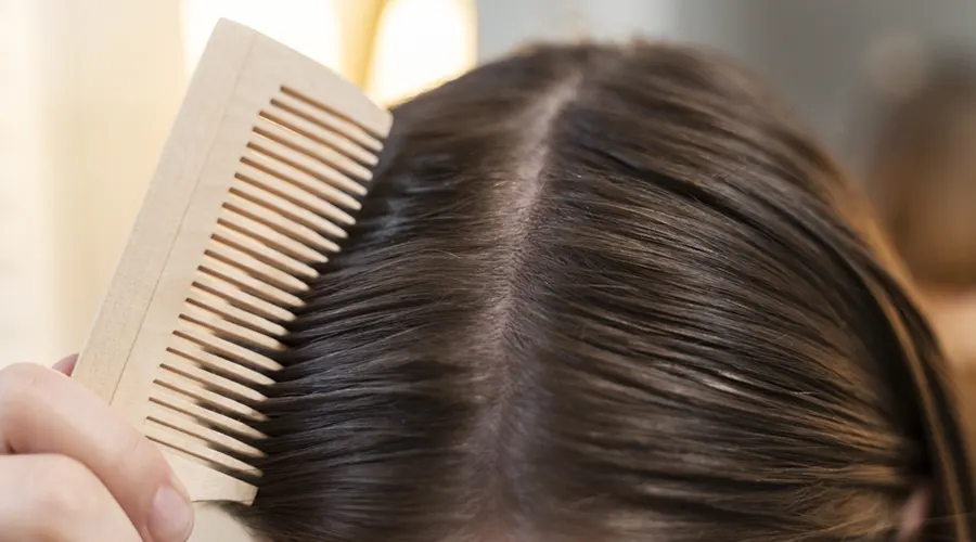 استفاده از روغن رزماری برای چربی کف سر