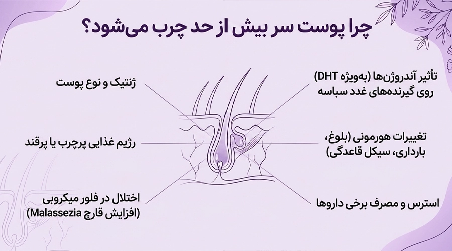 روغن مورد برای پوست سر چرب ؛ بررسی علمی و نحوه استفاده صحیح • مهر ۱۷ام, ۱۴۰۵ دلایل ایجاد پوست سر چرب