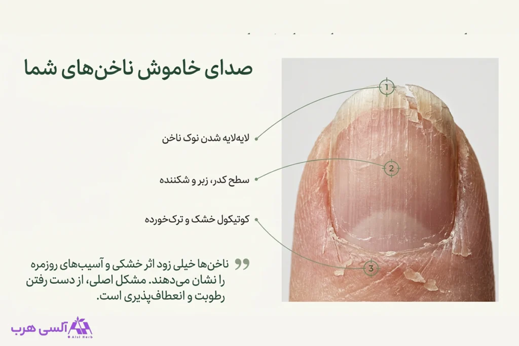 خواص روغن دم اسب برای ناخن؛ راهنمای کامل مراقبت از ناخنهای شکننده • مهر ۱۷ام, ۱۴۰۵ انواع مشکلات ناخن از جمله کوتیکول خشک، سطح ناخن شکننده و لایه لایه شدن نوک ناخن